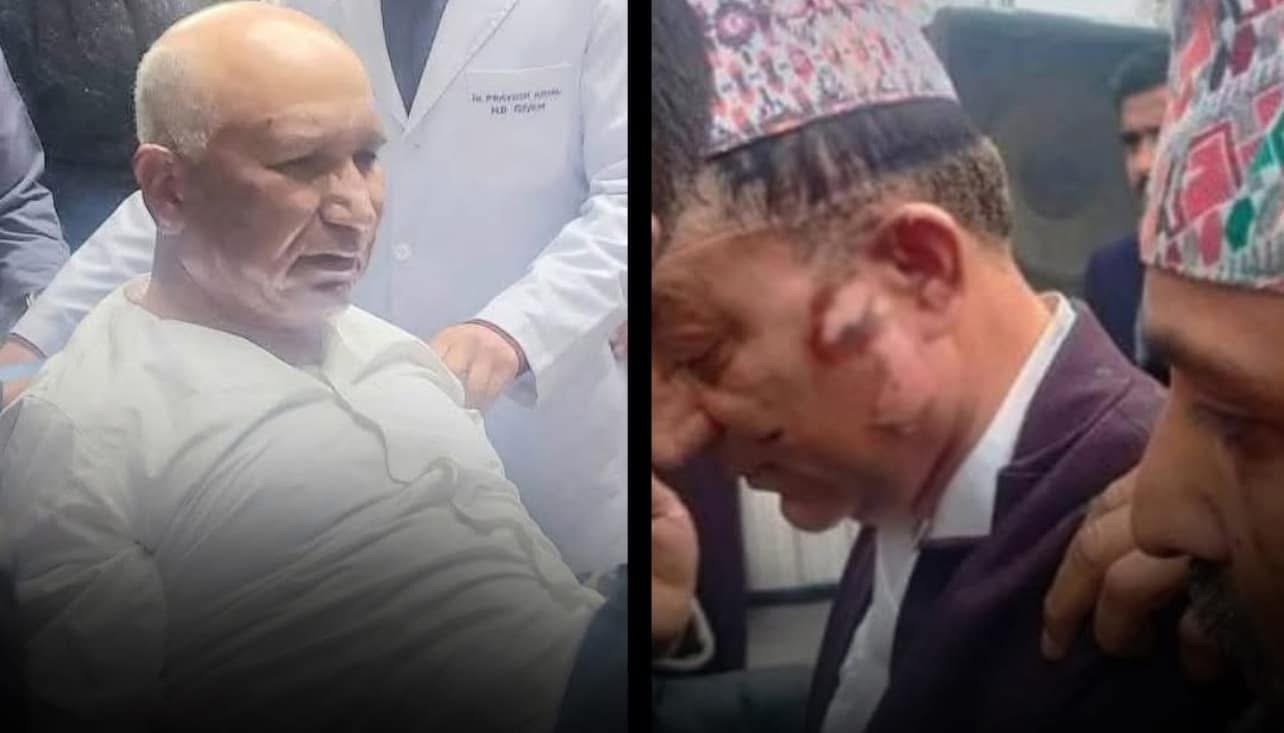 अर्थमन्त्री पौडेल र मेयर आचार्यलाई ५-६ प्रतिशत जलन